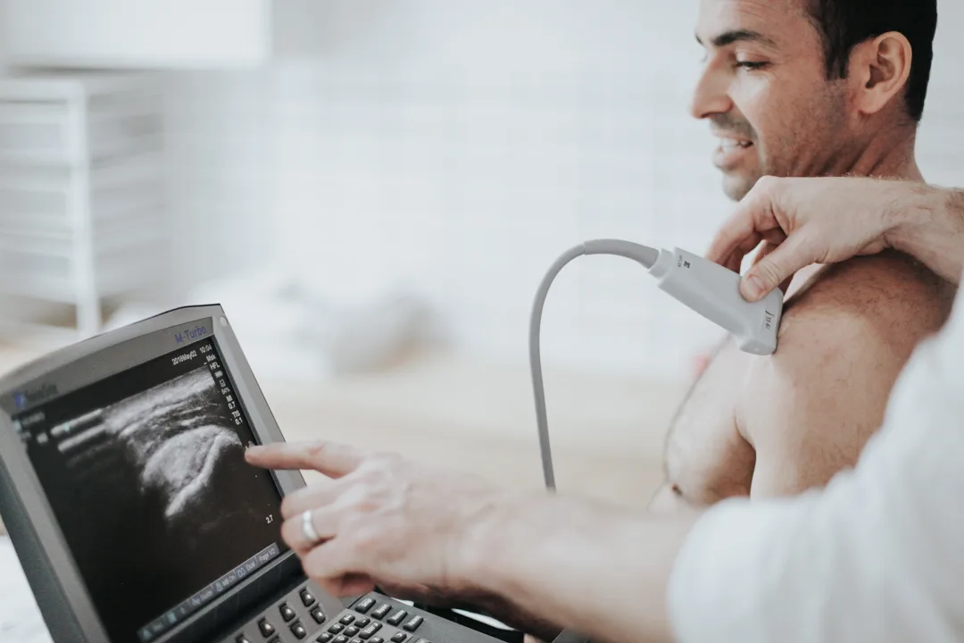 Steroid Injections for shoulder bursitis - ultrasound guided injection