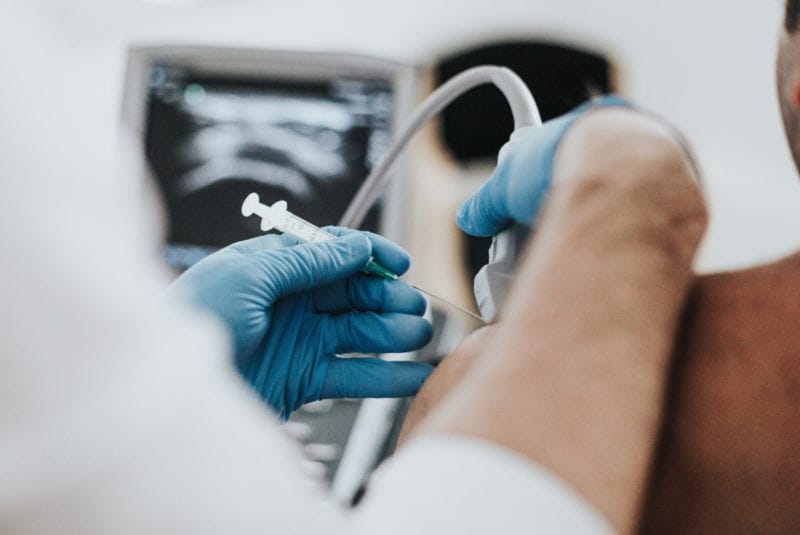 How many steroid injections can I have? Ultrasound Guided Injections