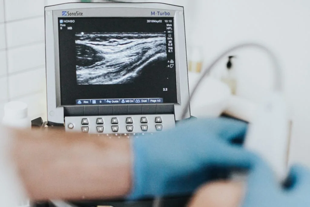 Cortisone Injections