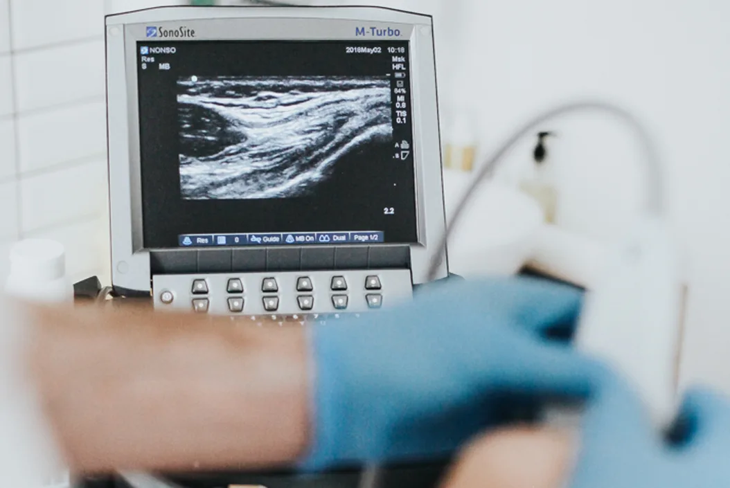Cortisone Injection - A view of an ultrasound screen
