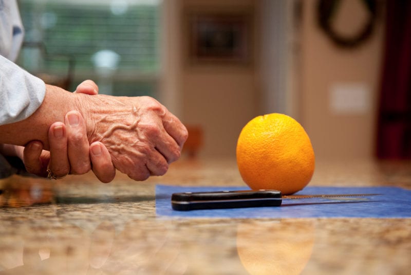 Steroid injection conditions - An orange and a knife on a table with an elderly man's hands in view, one holding the other.
