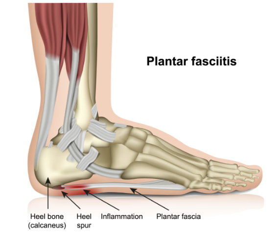 plantar fascia - diagram of the internal structure of the foot.