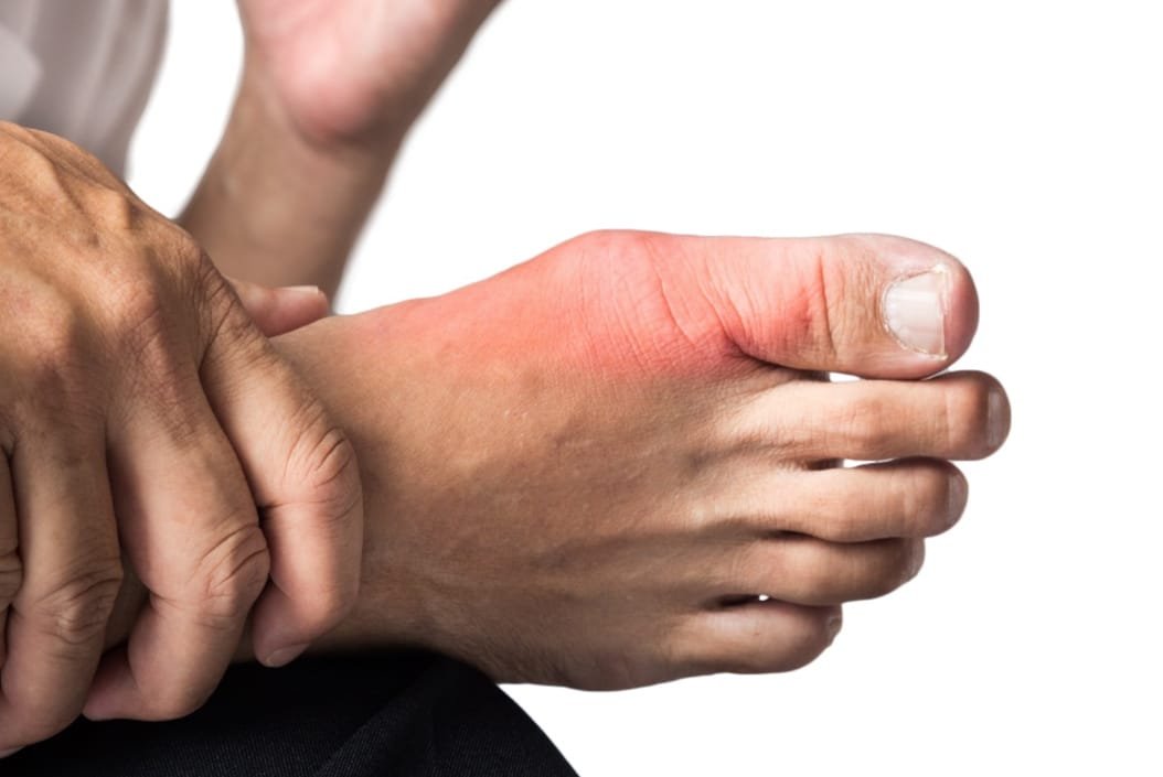 Osteoarthritis - Image of a bare foot with the big toe area highlighted in red.