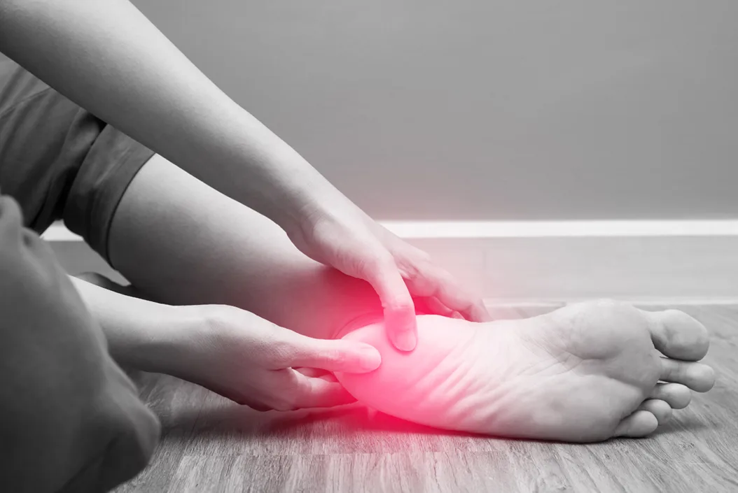 Plantar Fasciitis - Bursitis