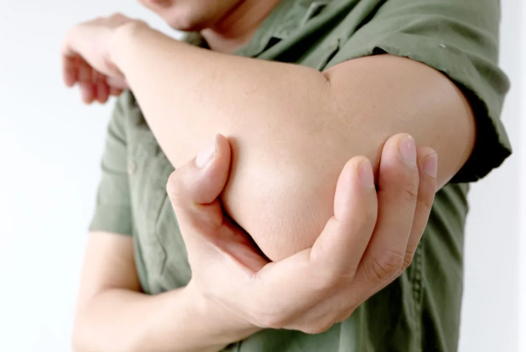 Cubital Tunnel Syndrome