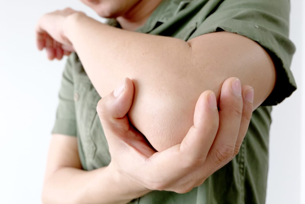 Cubital Tunnel Syndrome