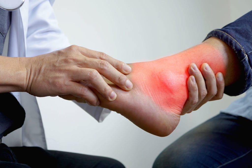 Lateral ankle ligament sprain