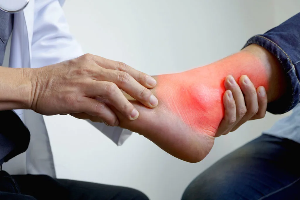 Lateral ankle ligament sprain