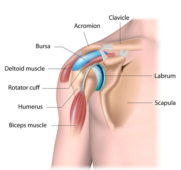 calcific tendinopathy ultrasound-guided_injection_shoulder_rotator-cuff