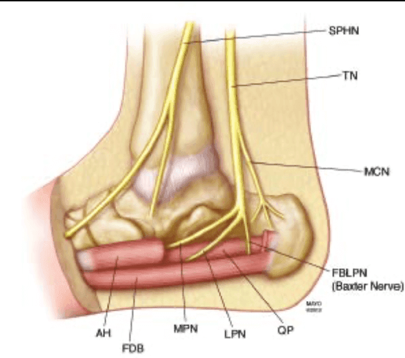Baxter s nerve entrapment Ultrasound Guided Injections