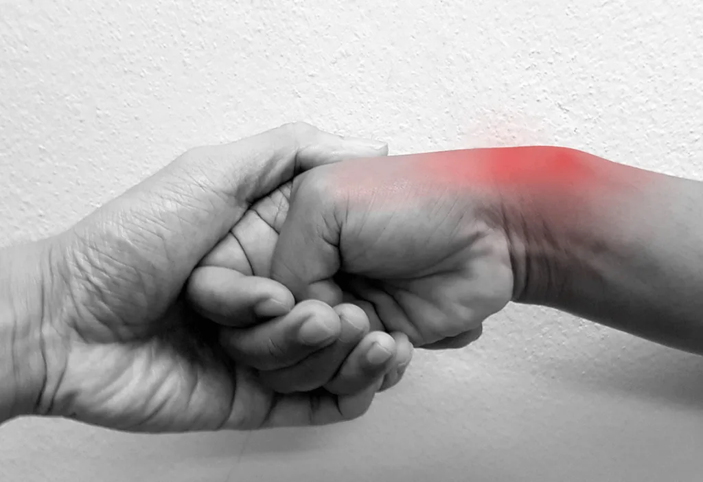 DeQuervain’s tenosynovitis