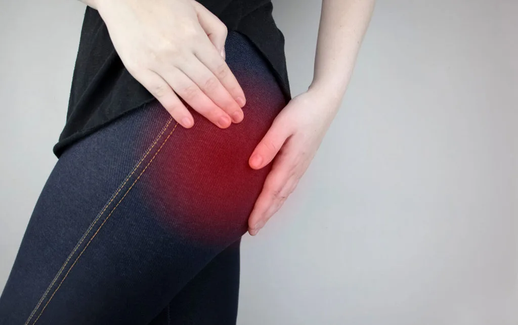 Piriformis Syndrome