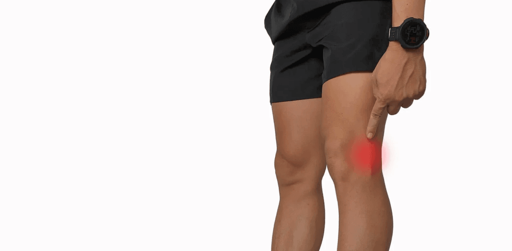 ITB Friction Syndrome – one month before the marathon, what can you do?
