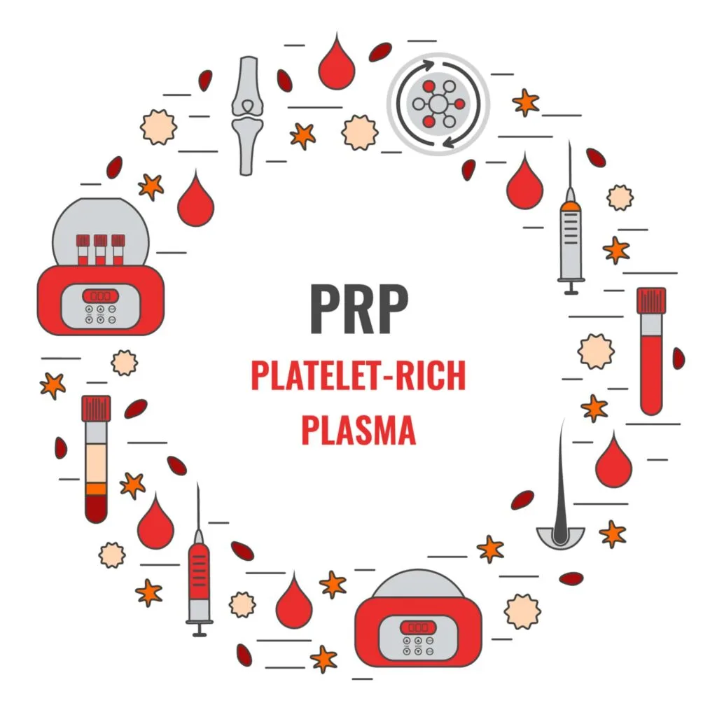 What is platelet rich plasma?