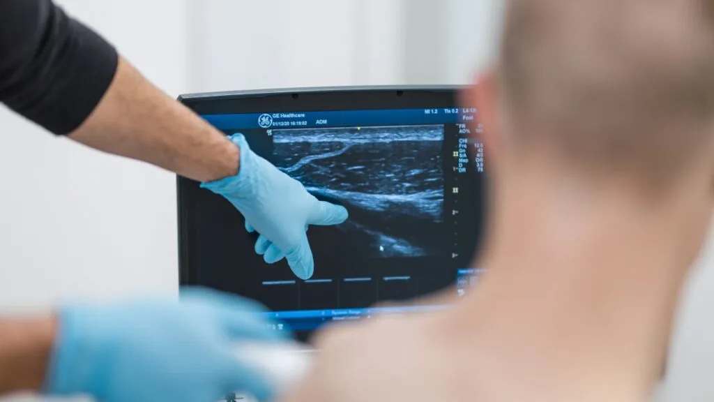 Comparing pseudoseptic arthritis and sepsis following a hyaluronic acid (HA) injection