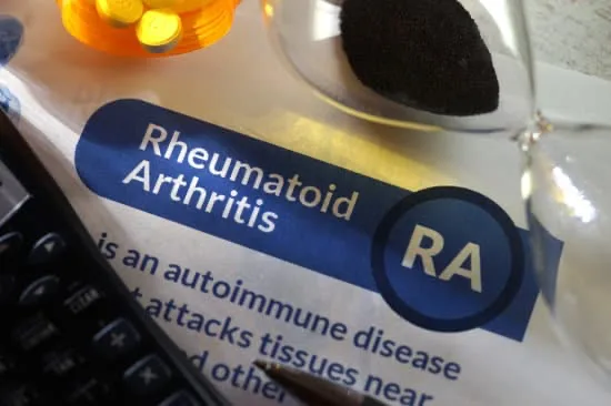 The Role of Ultrasound Guided Steroid Injections for Treating Rheumatoid Arthritis