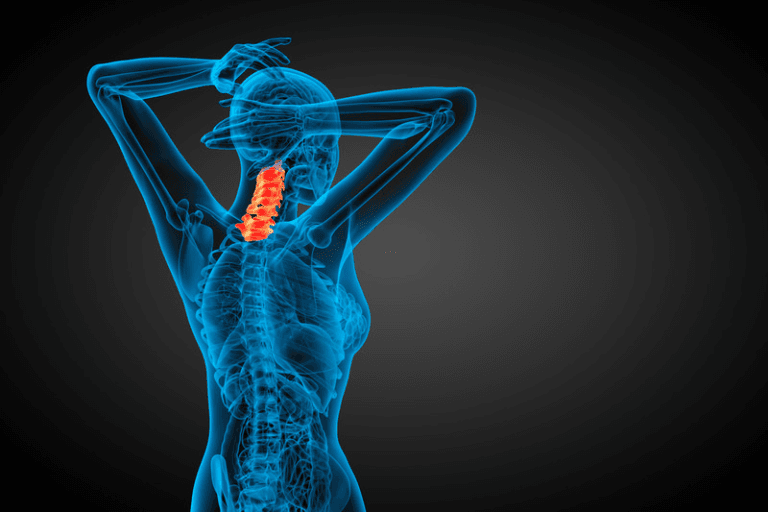 Cervical Facet Joint Pain