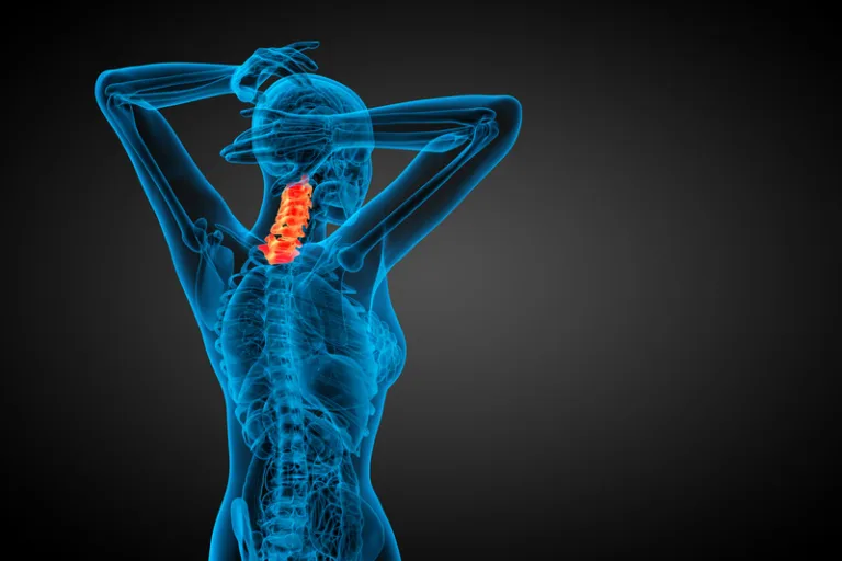 Cervical Facet Joint Pain