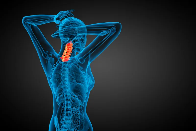 Cervical Facet Joint Pain