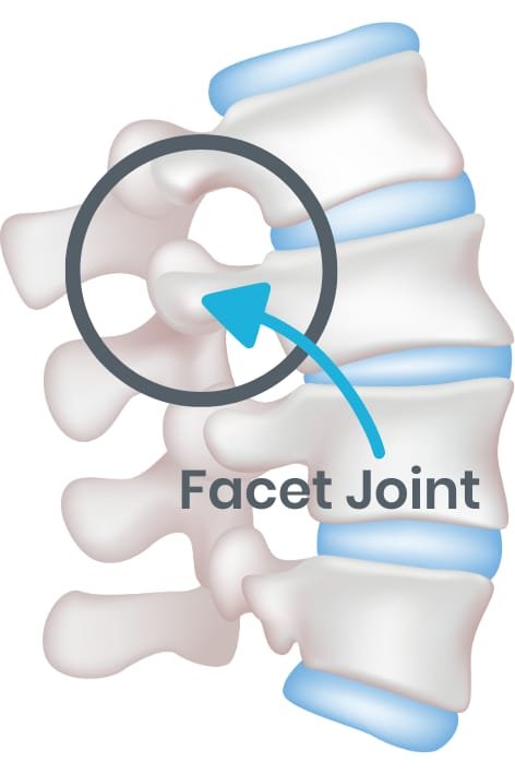 spinal-facet-joint